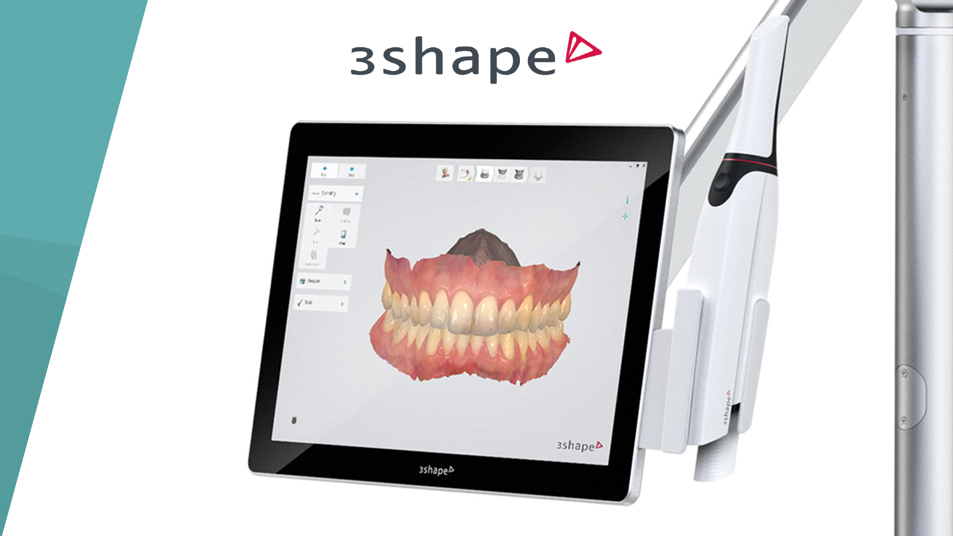 We use modern technologies for 3D teeth scans directly in the oral cavity for the convenience of the patient.